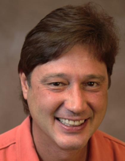 Allen smiling before smile makeover