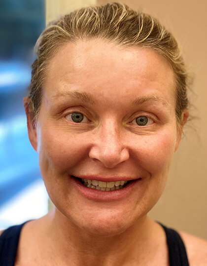 Maggie smiling before smile makeover