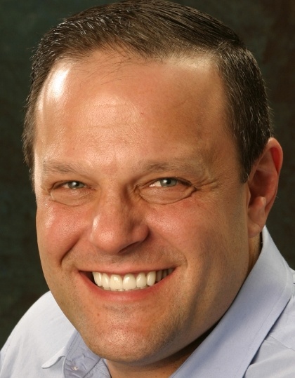 Closeup of Steve's smile before smile makeover