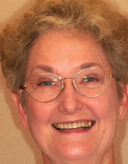 Jan smiling before smile makeover