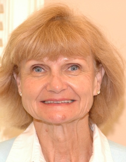 Joanne smiling before smile makeover