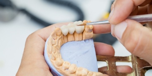 Lab technician crating a dental bridge