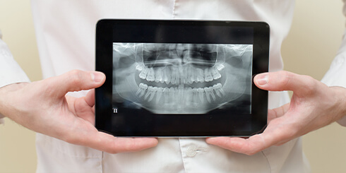 Digital dental x-rays on tablet computer screen