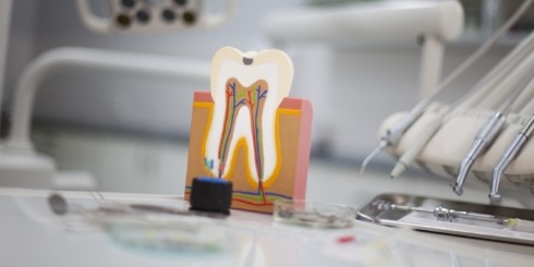 Model tooth used to explain scaling and root planing