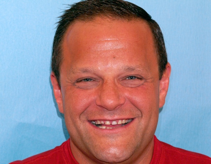 Steve's smile before smile makeover