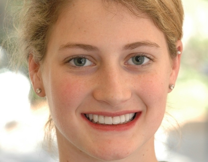 Rebecca smiling after smile makevoer