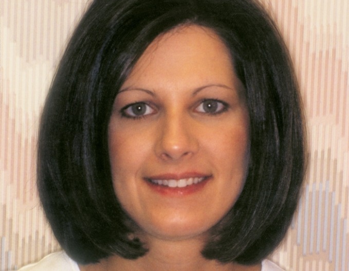 Angel smiling before smile makeover