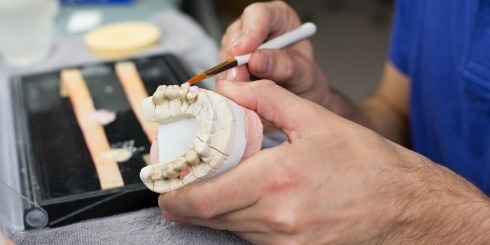 Dental lab technician crating inlays and onlays using a model smile