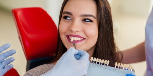 Woman's smile compared with veneers shade chart