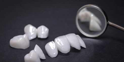 A close-up of veneers on a black background